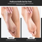 Pedicure Knife Kit, 8pcs Black Foot Dead Callus Remover Stainless Set, Professional Ingrown Toenail Steel Tools, Feet Skin Care Nail File Tool Manicure Clippers Cuticle Scraper Toe Shaver